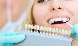 Transform Your Smile with Expert Care: Choosing a Charlotte Cosmetic Dentist