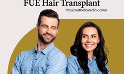 Discover the Revolutionary FUE Hair Transplant in Islamabad