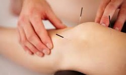 Relief Through Needles: Exploring Acupuncture for Knee Pain