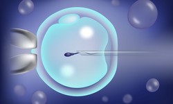 Experience Excellence: ICSI Treatment in Delhi at Prime IVF