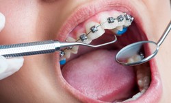 5 Common Tooth Problems And Ways To Prevent Them