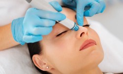 What Is a HydraFacial and How Does It Work?