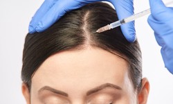 Is the Hair Transplant in Dubai procedure painful?