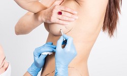 The Quest for Perfection: Navigating Breast Enlargement Injections in Dubai