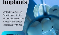 Your Trusted Parramatta Dentist: Where Comfort Meets Quality