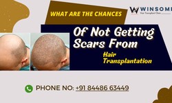 What Are The Chances Of Not Getting Scars From Hair Transplantation?