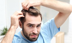 Education and awareness campaigns related to Hair Restoration in Dubai