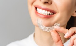 Beyond Straight Teeth: The Hidden Benefits of Braces