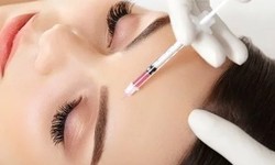 The Science of Beauty: Facial Botox Explained in Dubai