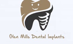 Enhance Your Confidence with Dental Implants: Glen Mills, PA Insights