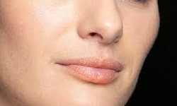Transform Your Appearance: Nose Bump Fillers in Riyadh