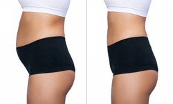 Get the Look You Desire: Buttock Augmentation Cost in Muscat