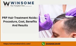PRP Hair Treatment Noida : Procedure, Cost, Benefits And Results