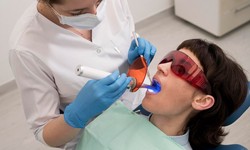 Tooth whitening Treatment: How it works- Procedure and Aftercare