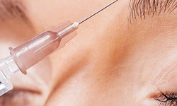 What is Hair Botox Treatment? Benefits, Price & How It Works