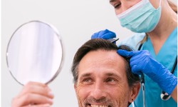 How to Choose the Right Hair Restoration Clinic in Sacramento?