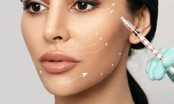 Can Under Eye Filler Injections Provide Natural-Looking Results?