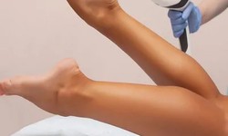Unlocking the Secrets of Full Body Laser Hair Removal: Insights from Dubai Experts
