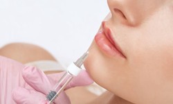 Find the Best Cheek Fillers Clinic in Muscat Today