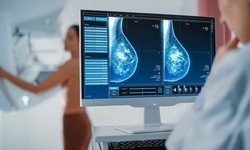 Artificial intelligence revealed signs of cancer in women - doctors did not find them