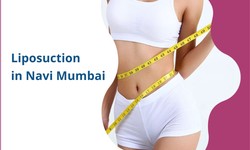 Transforming Bodies: Exploring Liposuction in Navi Mumbai with Dr. Vinod Vij, Pioneer of Plastic Surgery
