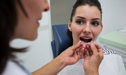 Chipped Tooth: Treatment Options Based on Severity