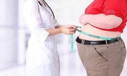 The Role of Nutrition in Maximising Weight Loss Surgery Results