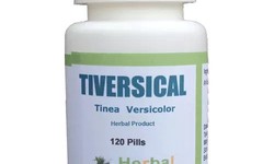 5 Best Home Remedies For Tinea Versicolor