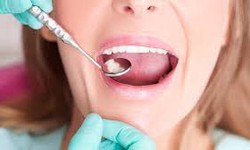 How Poor Dental Care Can Cause Mouth Cancer