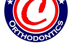 Advantages Of Using Expert Orthodontists for Invisalign Treatment