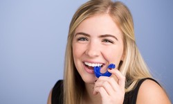 Ultimate Guide to Choosing the Right Mouthguard for Sports