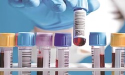 What does a creatine kinase blood test measure?