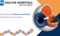 The Link Between Diabetes and Retinal Health: What You Need to Know