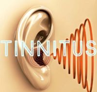Tinnitus Supplementreviews