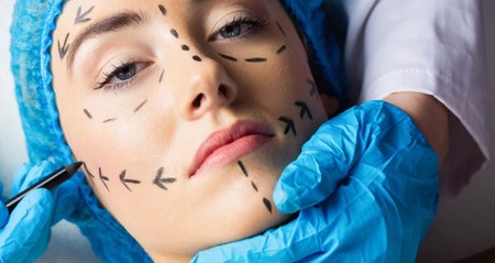 Questions You Should Ask Before Cosmetic Surgery