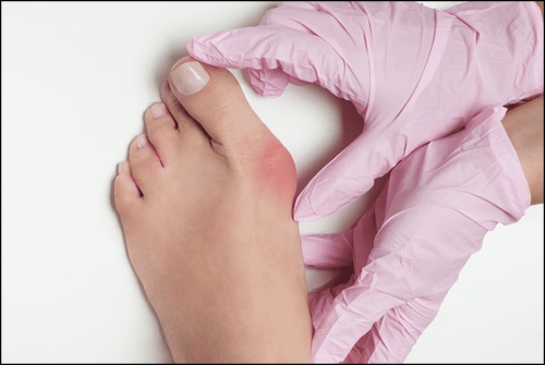 4 Types of Foot and Ankle Conditions, Causes, Symptoms, and Treatments