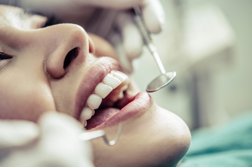 Root Canal Treatment And Its Importance