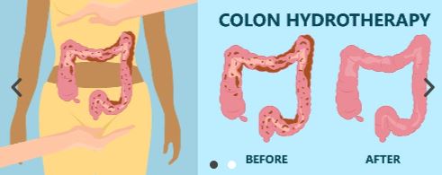 In that case, are Colonic Hydrotherapy cleanses risk-free