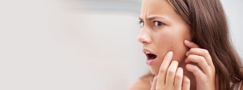 Learn Why You Need Acne Scar Treatment to Look Flawless