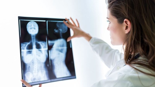 Steps to Detecting Breast Cancer Early