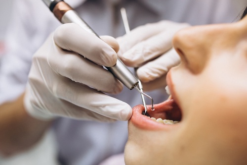 Preventive Care and Prevention in General Dentistry