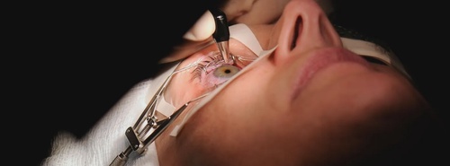 Lasik Eye Surgery & its Benefits