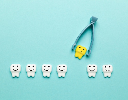 Wisdom Teeth Removal: Is It Worth the Cost?