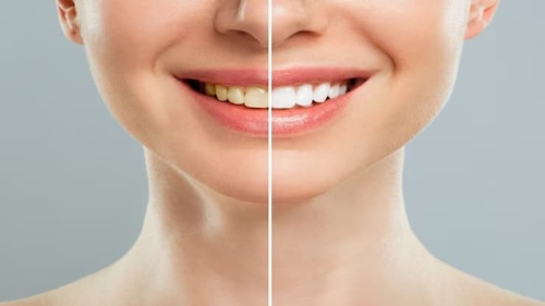 Your Guide to Top Dentists in Morgantown: Finding Your Perfect Smile Partner