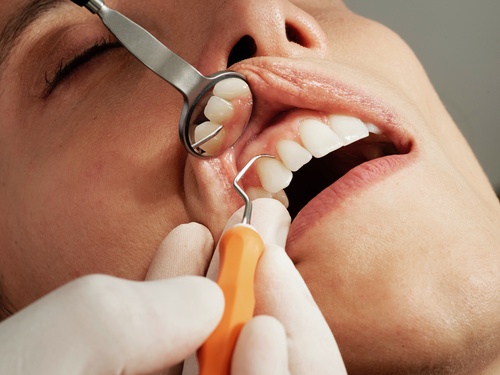 Exploring the Advantages of Cosmetic Dentistry Services