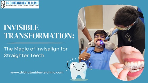 Invisible Transformation: The Magic of Invisalign for Straighter Teeth