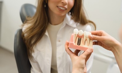 Discover the Benefits of Dental Implants