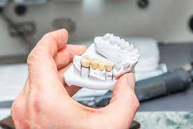 Dental Infections in Christchurch Treated with Root Canal Therapy