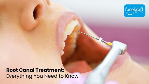 Say Goodbye to Tooth Pain: Root Canal Treatment at Face Kraft Clinic