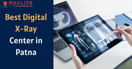 Understanding the Clear Benefits of Digital X-Ray at the Centre